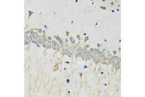 Immunohistochemistry of paraffin-embedded mouse brain using SERPINA4 antibody (ABIN4905121) at dilution of 1:100 (40x lens). (SERPINA4 抗体)