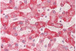 Rabbit Anti-HADH antibody Catalog Number: ARP54764 Formalin Fixed Paraffin Embedded Tissue: Human Adult Liver  Observed Staining: Cytoplasm in hepatocytes Primary Antibody Concentration: 1:600 Secondary Antibody: Donkey anti-Rabbit-Cy3 Secondary Antibody Concentration: 1:200 Magnification: 20X Exposure Time: 0. (HADH 抗体  (Middle Region))