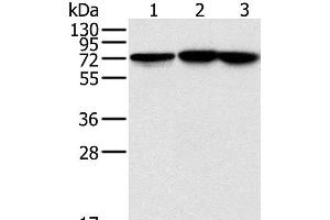 Western Blot analysis of Raji, Jurkat and hela cell using NDUFS1 Polyclonal Antibody at dilution of 1:800 (NDUFS1 抗体)