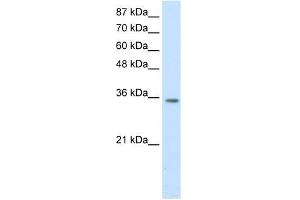 WB Suggested Anti-HOXD4 Antibody Titration:  1. (HOXD4 抗体  (C-Term))