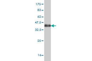 Western Blot detection against Immunogen (36. (ABL2 抗体  (AA 743-842))