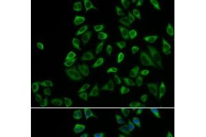 Immunofluorescence analysis of HeLa cells using PEX5 Polyclonal Antibody (PEX5 抗体)