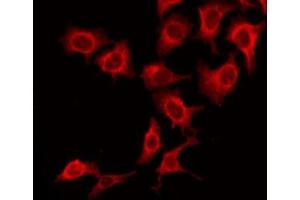 ABIN6277137 staining Hela by IF/ICC. (ATF2 抗体  (N-Term))