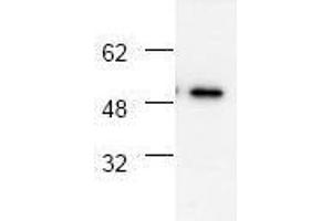 Image no. 1 for anti-Tumor Necrosis Factor Receptor Superfamily, Member 1A (TNFRSF1A) antibody (ABIN127018) (TNFRSF1A 抗体)