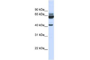 WB Suggested Anti-PARD6B Antibody Titration:  0. (PARD6B 抗体  (N-Term))