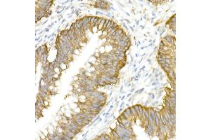 Immunohistochemistry (IHC) image for anti-Solute Carrier Family 12 (Potassium-Chloride Transporter) Member 2 (SLC12A2) (AA 120-280) antibody (ABIN6147843)