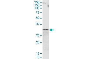 ORM1 MaxPab rabbit polyclonal antibody. (ORM1 抗体  (AA 1-201))
