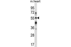 Western Blotting (WB) image for anti-UDP-Gal:betaGlcNAc beta 1,3-Galactosyltransferase, Polypeptide 2 (B3GALT2) antibody (ABIN2998023) (B3GALT2 抗体)