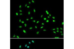 Immunofluorescence analysis of A549 cells using SMARCAD1 Polyclonal Antibody (SMARCAD1 抗体)