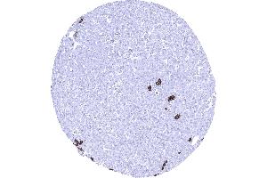 Liver Strong Trop 2 staining in intrahepatic bile ducts of the liver (Recombinant TACSTD2 抗体  (AA 31-274))
