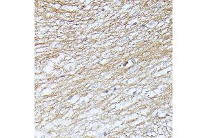 Immunohistochemistry of paraffin-embedded rat brain using Septin 5 antibody (ABIN6128759, ABIN6147556, ABIN6147557 and ABIN6216776) at dilution of 1:100 (40x lens). (Septin 5 抗体  (AA 1-369))