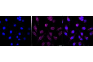 anti-Nemo-Like Kinase (NLK) antibody