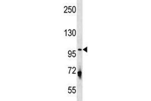 ULK1 antibody western blot analysis in U251 lysate.
