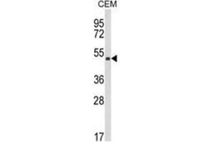 Western blot analysis of KMO Antibody (Center) in CEM cell line lysates (35ug/lane). (KMO 抗体  (Middle Region))