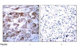 Image no. 3 for anti-B-Cell CLL/lymphoma 2 (BCL2) (Ser70) antibody (ABIN197204) (Bcl-2 抗体  (Ser70))