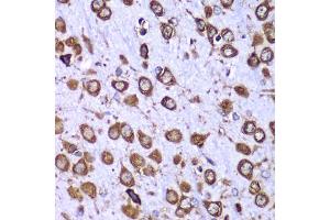 Immunohistochemistry of paraffin-embedded mouse brain using RPS10 antibody (ABIN6132945, ABIN6147192, ABIN6147194 and ABIN6221686) at dilution of 1:100 (40x lens). (RPS10 抗体  (AA 1-165))