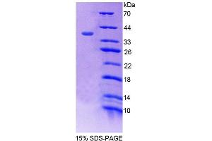 SDS-PAGE analysis of Mouse SNTb1 Protein. (SNTB1 蛋白)