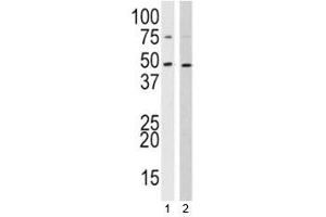 Western blot analysis of SUV39H2 antibody and 1) 293, 2) HL-60 lysate (SUV39H2 抗体  (AA 360-390))