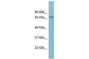 WB Suggested Anti-SLC27A5 Antibody Titration:  0. (SLC27A5 抗体  (Middle Region))