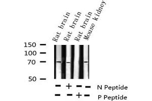 Western Blotting (WB) image for anti-Protein tyrosine Phosphatase, Non-Receptor Type 11 (PTPN11) (pTyr580) antibody (ABIN6256769)