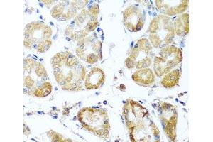 Immunohistochemistry of paraffin-embedded Human stomach using PER1 Polyclonal Antibody at dilution of 1:100 (40x lens). (PER1 抗体)