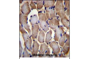 SEPN1 Antibody (C-term) (ABIN656385 and ABIN2845680) immunohistochemistry analysis in formalin fixed and paraffin embedded human skeletal muscle followed by peroxidase conjugation of the secondary antibody and DAB staining. (SEPN1 抗体  (C-Term))