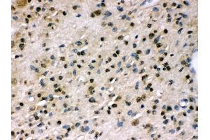 Anti- PPP1R12A Picoband antibody,IHC(P) IHC(P): Human Glioma Tissue (PPP1R12A 抗体  (N-Term))