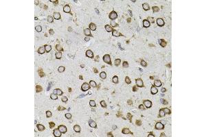 Immunohistochemistry of paraffin-embedded mouse brain using CEP164 antibody (ABIN6131021, ABIN6138417, ABIN6138418 and ABIN6225304) (40x lens). (CEP164 抗体  (AA 730-829))