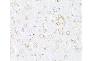Immunohistochemistry (Paraffin-embedded Sections) (IHC (p)) image for anti-Arachidonate 12-Lipoxygenase (ALOX12) antibody (ABIN7258054)