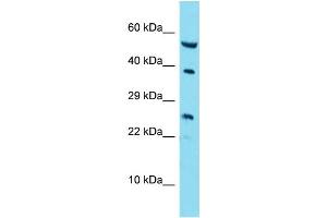 Host: Rabbit Target Name: RAB42 Sample Type: A549 Whole Cell lysates Antibody Dilution: 1. (RAB42 抗体  (C-Term))