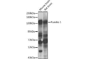 Western blot analysis of extracts of various cell lines, using Pumilio 1 antibody  at 1:1000 dilution. (PUM1 抗体  (AA 1-280))