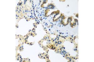 Immunohistochemistry of paraffin-embedded rat lung using LLGL2 antibody (ABIN5975836) at dilution of 1/200 (40x lens). (LLGL2 抗体)