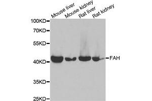 Western blot analysis of extracts of various cell lines, using FAH antibody. (FAH 抗体)