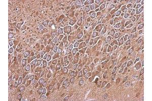 IHC-P Image Immunohistochemical analysis of paraffin-embedded CL1-5 xenograft, using RP105, antibody at 1:500 dilution. (CD180 抗体)