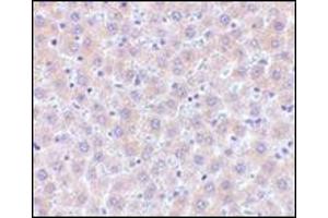 Immunohistochemistry of sRANK-L in human liver tissue with this product at 5 μg/ml. (RANKL 抗体  (Center))