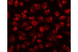IF analysis of CDK13 using anti-CDK13 antibody (ABIN7599667).