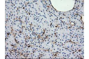 Image no. 1 for anti-Alcohol Dehydrogenase 1B (Class I), beta Polypeptide (ADH1B) antibody (ABIN1496479) (ADH1B 抗体)