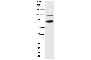 Western blot analysis of TCF4 expression in SH-SY5Y cell lysate.