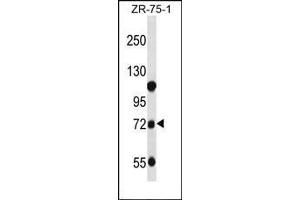 Western blot analysis of Beta-glucuronidase Antibody (C-term) in ZR-75-1 cell line lysates (35ug/lane).