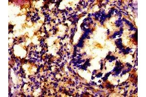 IHC image of ABIN7154307 diluted at 1: 500 and staining in paraffin-embedded human lung tissue performed on a Leica BondTM system.