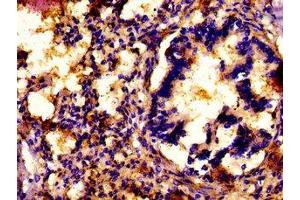 IHC image of ABIN7154307 diluted at 1: 500 and staining in paraffin-embedded human lung tissue performed on a Leica BondTM system. (ATP7A 抗体  (AA 257-488))