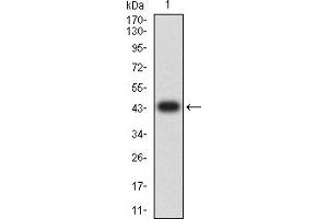 Western blot analysis using CD11a mAb against human CD11a (AA: extra 26-194) recombinant protein.