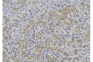 Immunohistochemistry (IHC) image for anti-Wingless-Type MMTV Integration Site Family, Member 3A (WNT3A) (Internal Region) antibody (ABIN6266040)