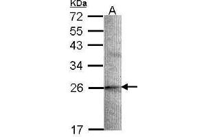 WB Image Sample (30 ug of whole cell lysate) A: A549 12% SDS PAGE antibody diluted at 1:1000 (STMN2 抗体  (N-Term))