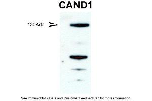WB Suggested Anti-CAND1 Antibody  Titration: 1 ug/ml Positive Control: mouse testis (CAND1 抗体  (Middle Region))