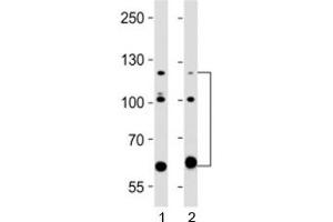 Western blot testing of ABL2 antibody at 1:2000 dilution. (ABL2 抗体)