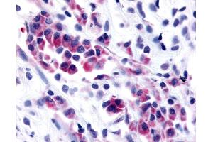 Immunohistochemistry (IHC) image for anti-NIMA (Never in Mitosis Gene A)- Related Kinase 9 (NEK9) (Kinase Domain) antibody (ABIN1049092)