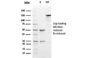 SDS-PAGE Analysis Purified Progesterone Receptor Mouse Monoclonal Antibody (PGR/2694). (Progesterone Receptor 抗体  (AA 483-571))