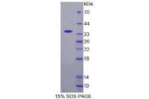 SDS-PAGE analysis of Human TCEA3 Protein. (TCEA3 蛋白)