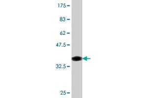 Western Blot detection against Immunogen (36. (ATRX 抗体  (AA 2311-2410))